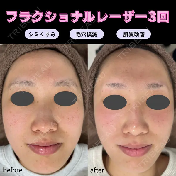 滋賀美容皮膚科クリニックの症例