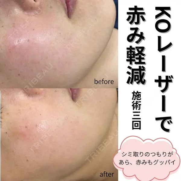 滋賀美容皮膚科クリニックの症例