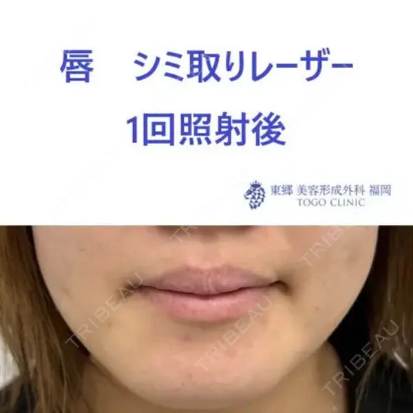 東郷美容形成外科　福岡の症例