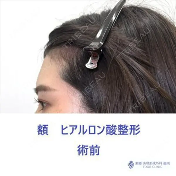 東郷美容形成外科　福岡の症例