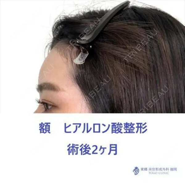 東郷美容形成外科　福岡の症例