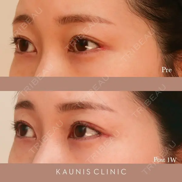 KAUNIS CLINIC（カウニスクリニック）の症例