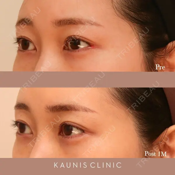 KAUNIS CLINIC（カウニスクリニック）の症例