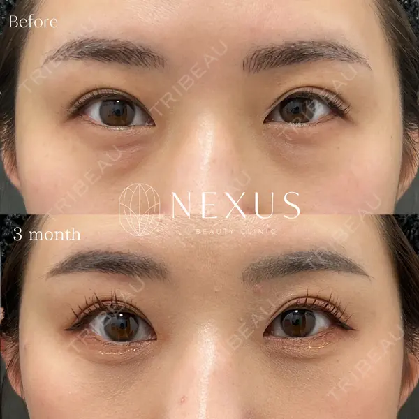 NEXUS CLINICの症例