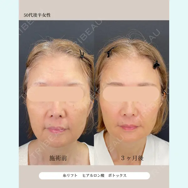 自由が丘ウェルエイジングビューティークリニック 福田 知佐子医師の症例