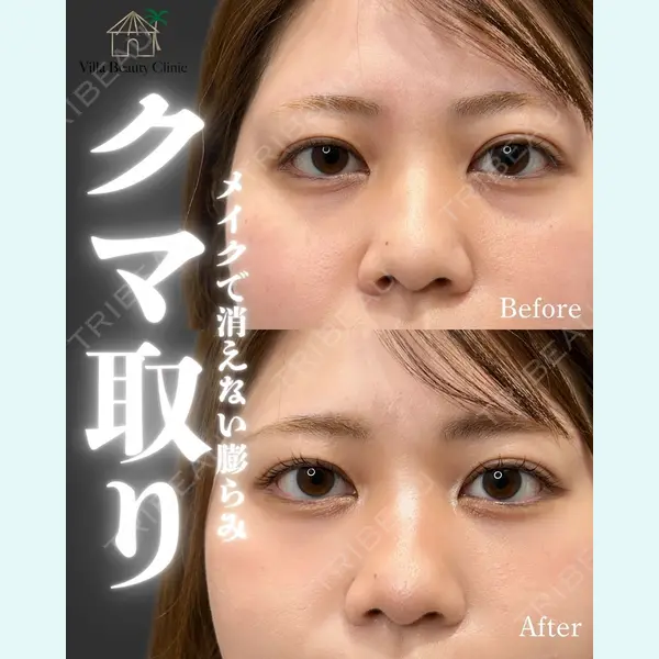 博多美容外科/美容皮膚科 ビラビューティークリニック 大村 亞蘭医師の症例