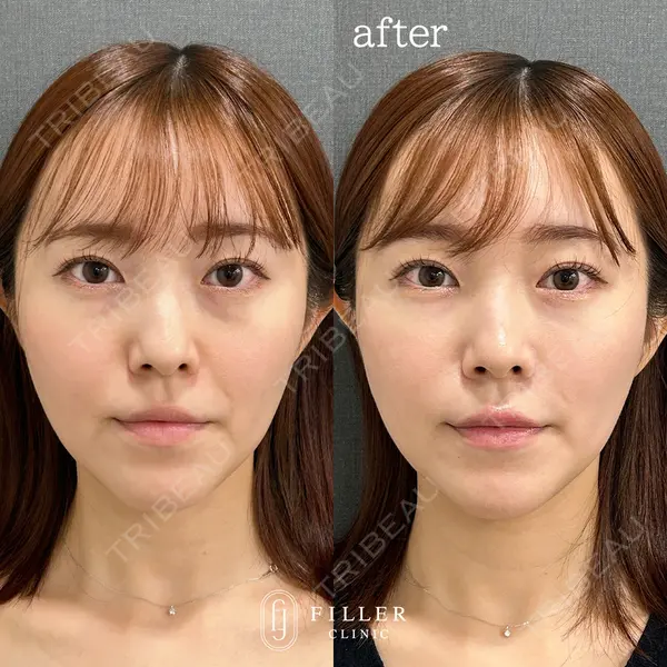 フィラークリニック 大阪梅田院の症例