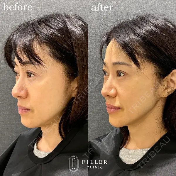 フィラークリニック 大阪梅田院の症例