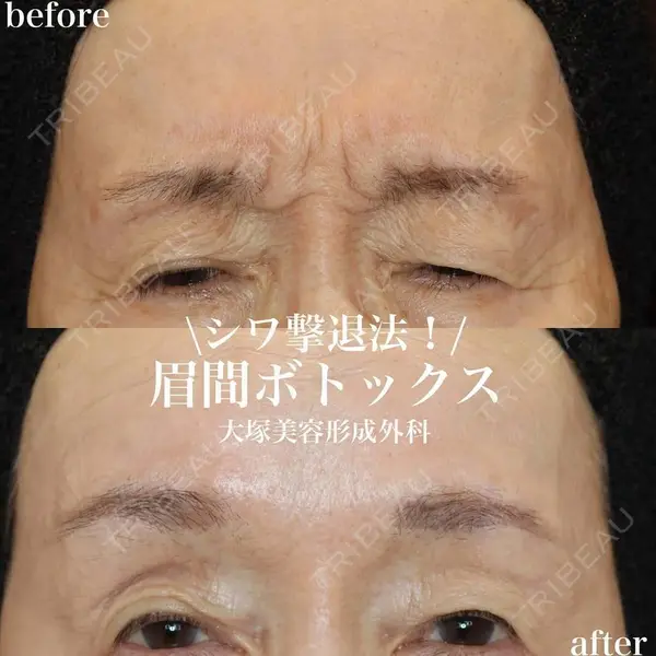 大塚美容形成外科 銀座本院 石井秀典医師の症例