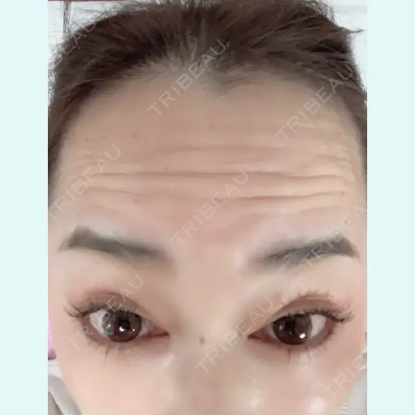 BG Medical Clinic 北澤 真歩医師の症例