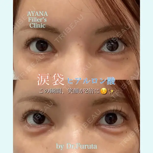 AYANAフィラーズクリニック 渋谷院 古田 晃医師の症例