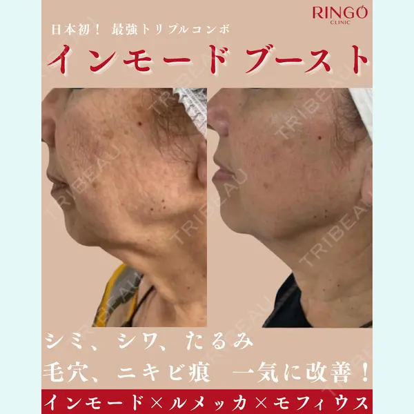 RINGO CLINIC 西田 有加莉医師の症例