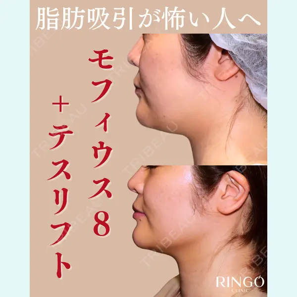 RINGO CLINIC 西田 有加莉医師の症例