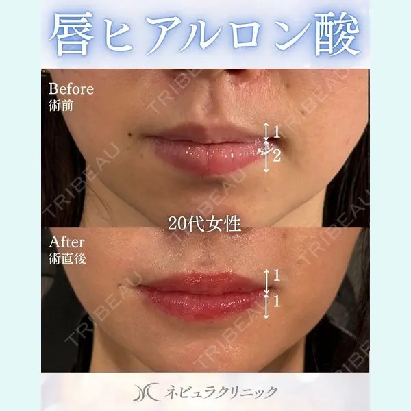 札幌美容外科ネビュラクリニック 横田 開医師の症例