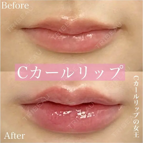 ルラ美容クリニック 渋谷本院 昼間 路子医師の症例