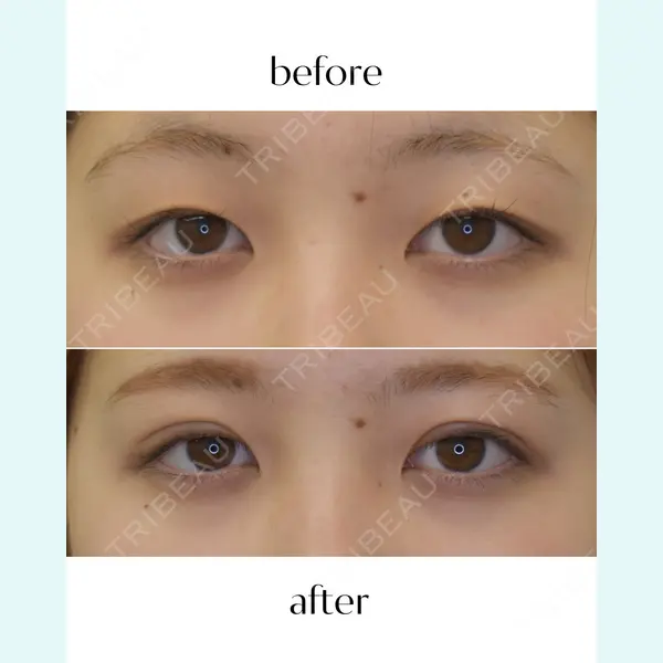 グレーススキンクリニック 江本　正樹医師の症例