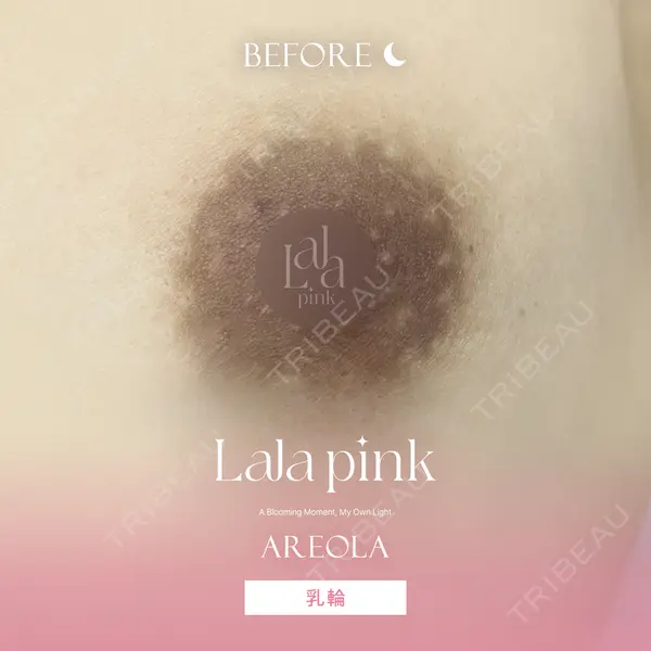 表参道メディカルクリニック 表参道院の症例