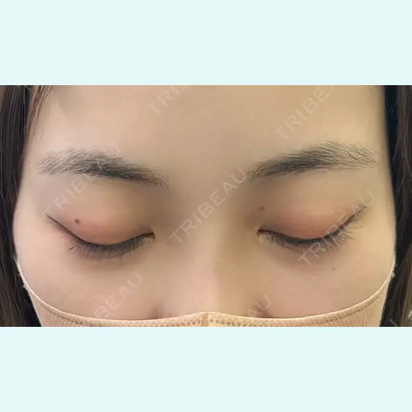 グランジョイクリニックの症例