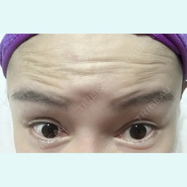 しんゆり美容健康クリニックの症例