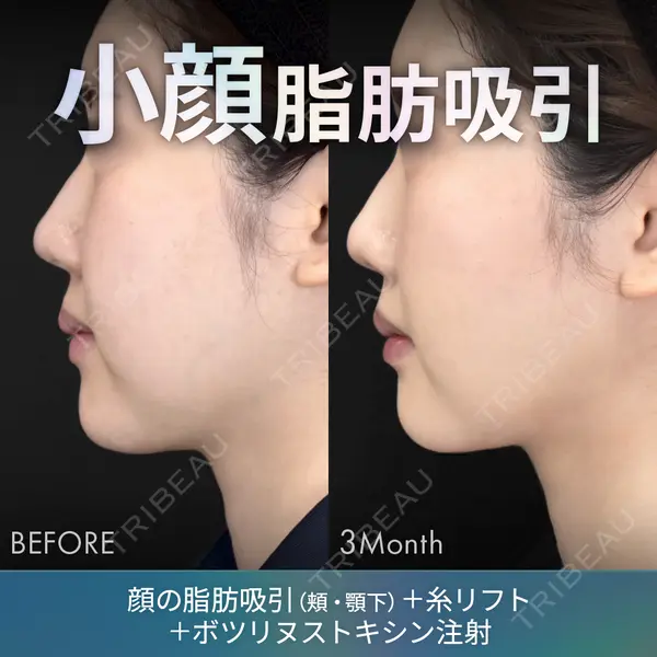 ジョウクリニック 銀座院 佐藤 光医師の症例