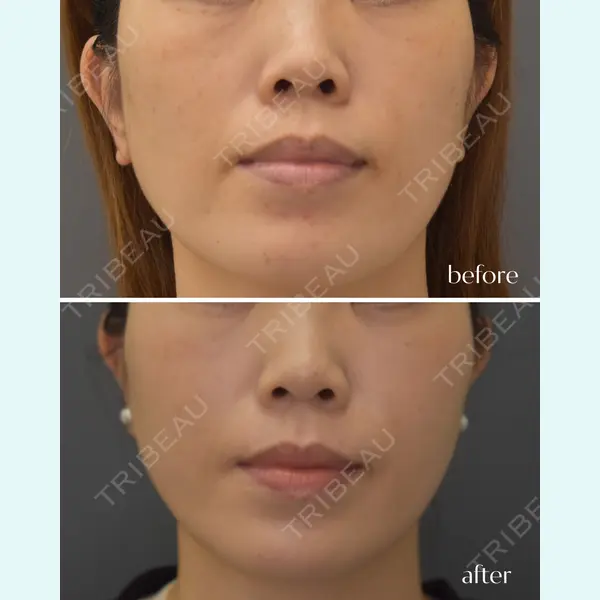 グレーススキンクリニック 橋田　清夏医師の症例