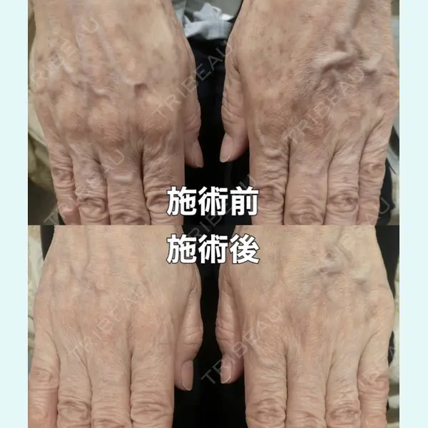 やさしい美容皮膚科・皮フ科　東京浅草院の症例