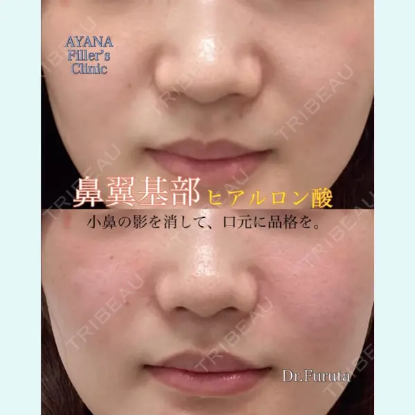 AYANAフィラーズクリニック 渋谷院 古田 晃医師の症例