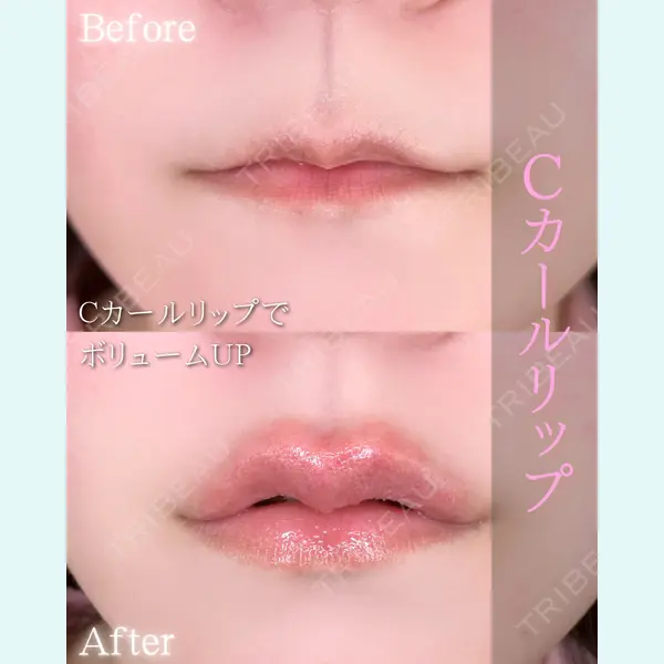 ルラ美容クリニック 大阪本院 平田 一記医師の症例