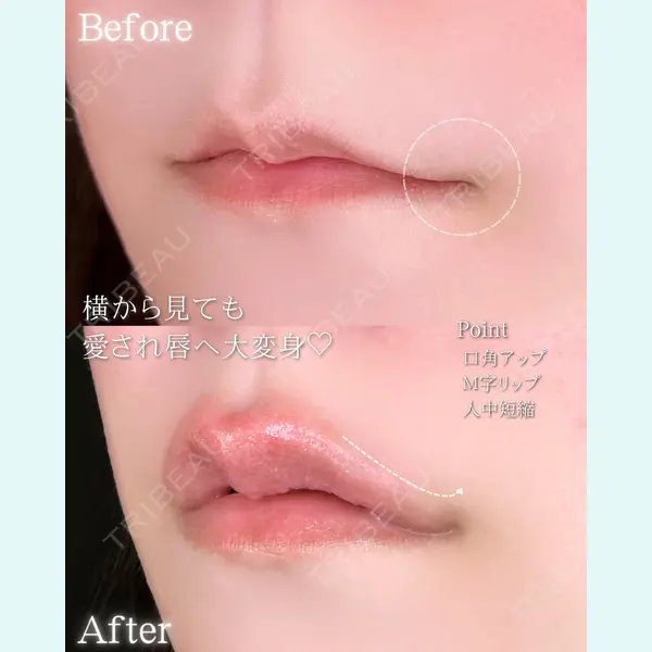 ルラ美容クリニック 大阪本院 平田 一記医師の症例