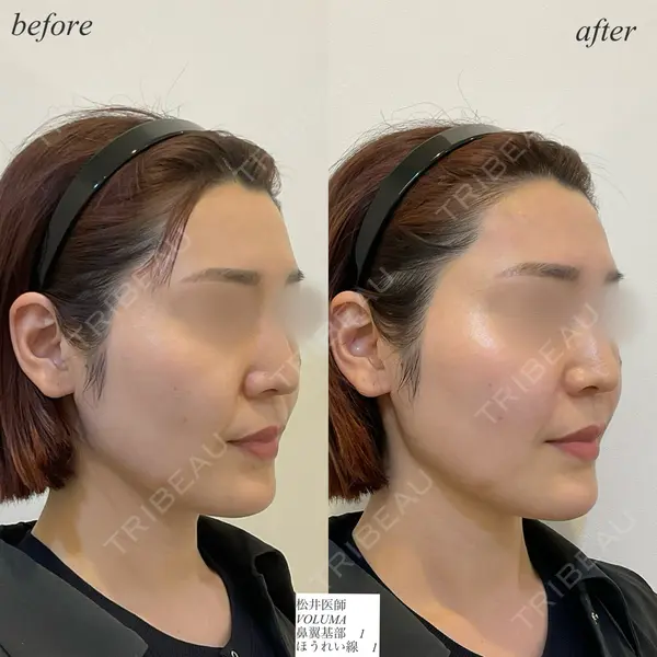 DMTC CLINIC 日本橋院 松井泉医師の症例