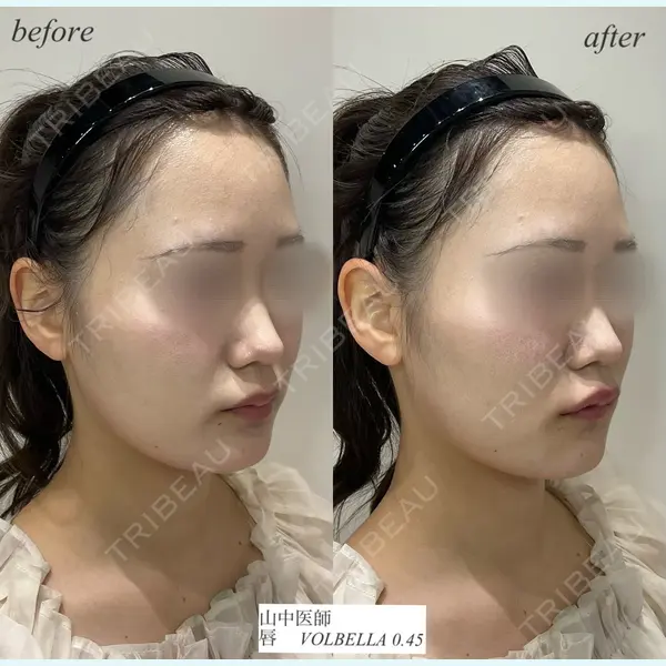 DMTC CLINIC 日本橋院 山中大介医師の症例