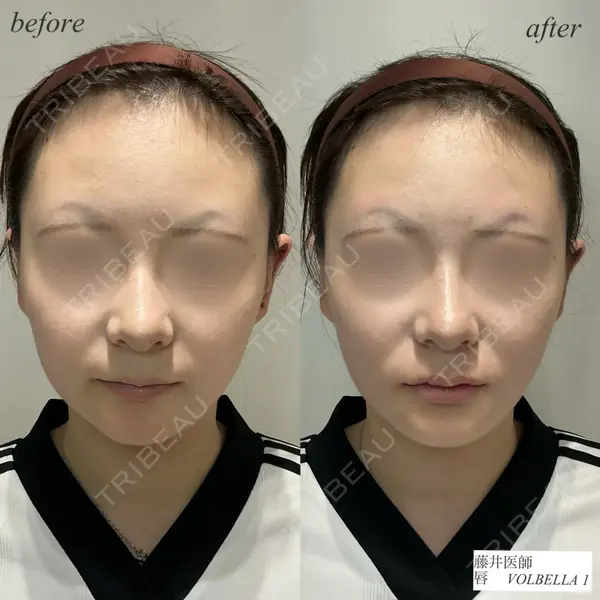 DMTC CLINIC 日本橋院 藤井壮人医師の症例