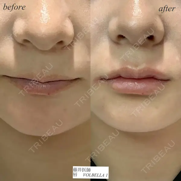 DMTC CLINIC 日本橋院 藤井壮人医師の症例