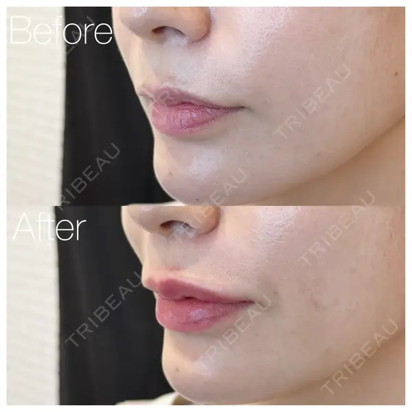 大美会クリニック 神戸院 益田沙也加医師の症例