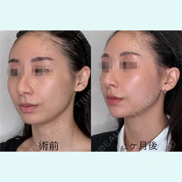 GRACY TOKYO CLINIC【グレイシートウキョウクリニック】 江本 正樹医師の症例