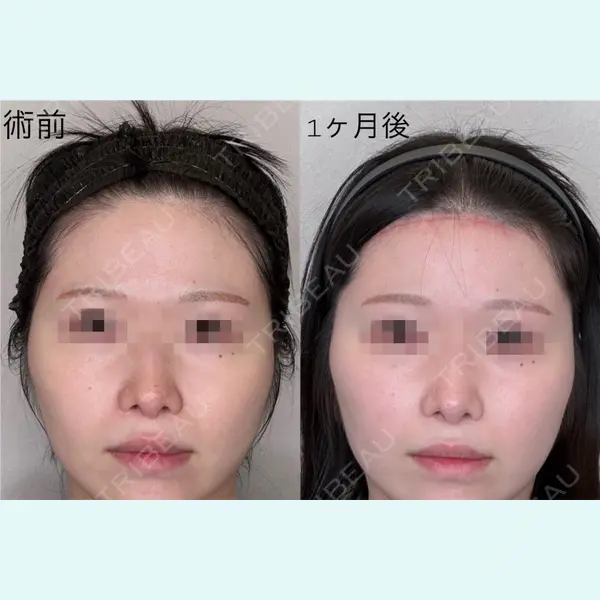 GRACY TOKYO CLINIC【グレイシートウキョウクリニック】 江本 正樹医師の症例