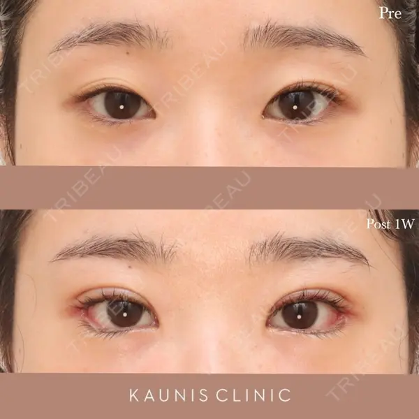 KAUNIS CLINIC（カウニスクリニック）の症例