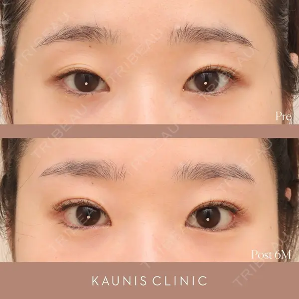 KAUNIS CLINIC（カウニスクリニック）の症例