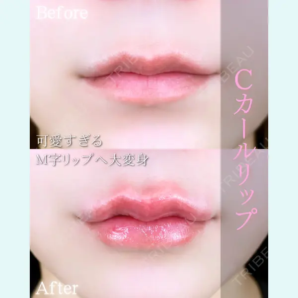 ルラ美容クリニック 大阪本院 平田 一記医師の症例