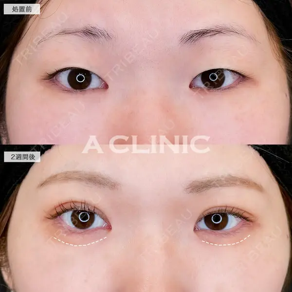 A CLINIC（エークリニック） 仙台院 伊藤 瑠桂医師の症例