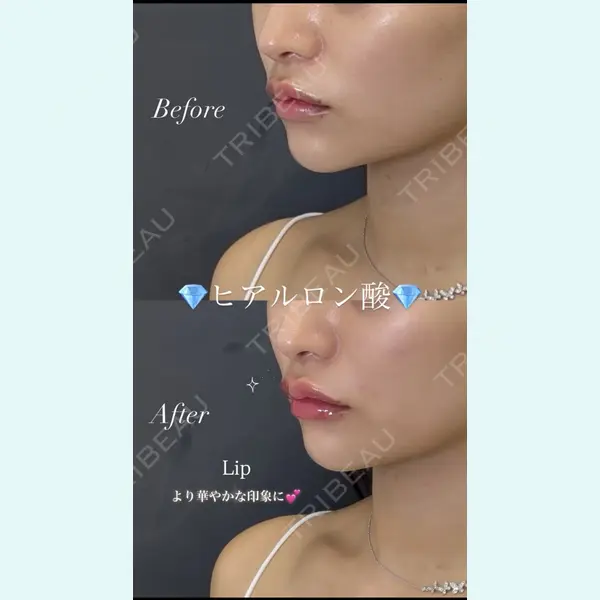 銀座美容外科クリニック 銀座院 藤森 徹也医師の症例