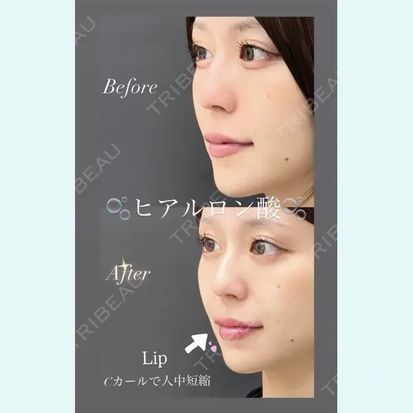 銀座美容外科クリニック 銀座院 藤森 徹也医師の症例