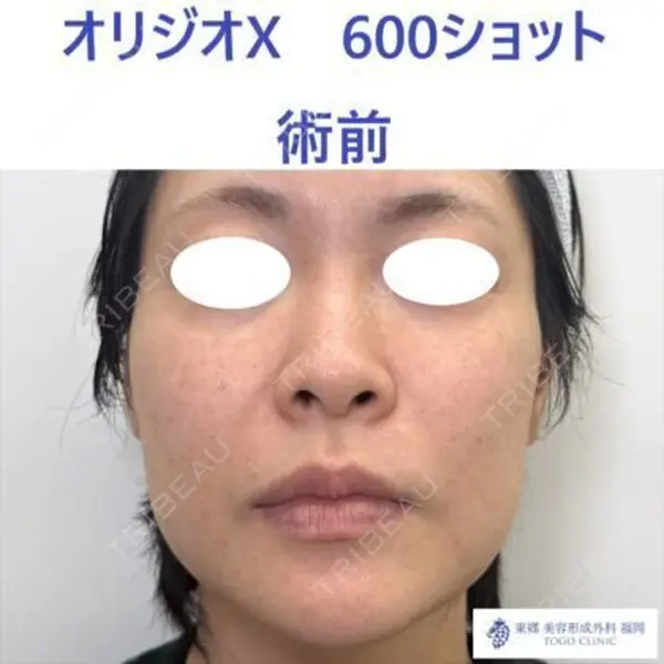 東郷美容形成外科　福岡の症例