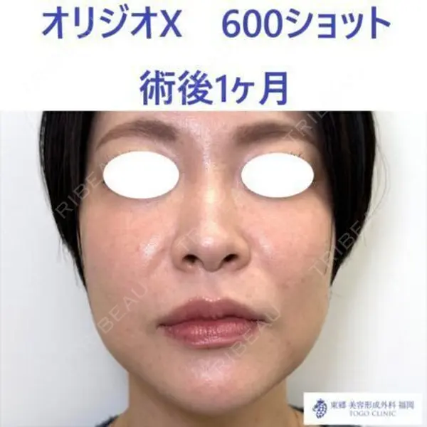 東郷美容形成外科　福岡の症例