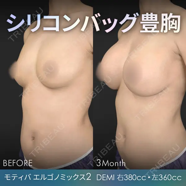 ジョウクリニック 銀座院 重本　譲医師の症例