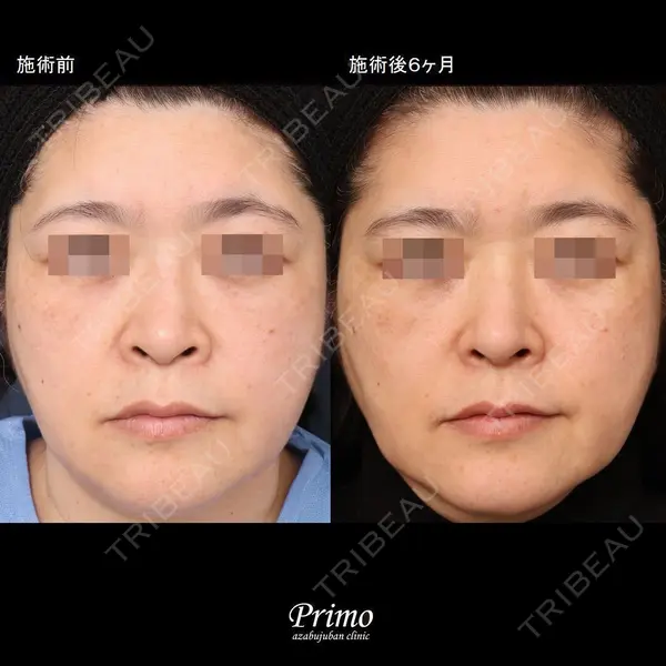 プリモ麻布十番クリニック 大場教弘医師の症例