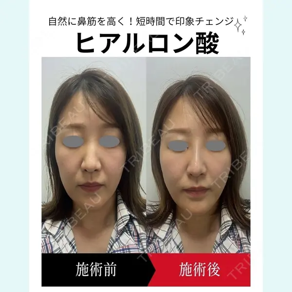 椿クリニック 名古屋院の症例