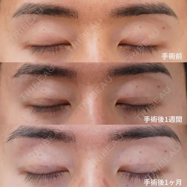 コスメディカルクリニック シンシア 渋谷院 村住 昌彦医師の症例