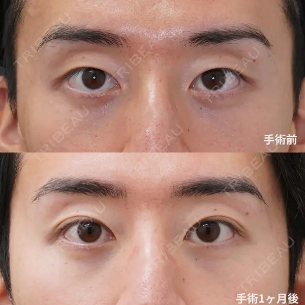 コスメディカルクリニック シンシア 渋谷院 村住 昌彦医師の症例