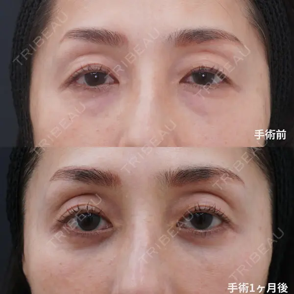 コスメディカルクリニック シンシア 渋谷院の症例